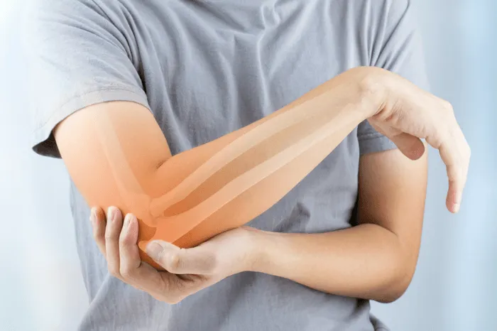myact-joint-pain-treatment